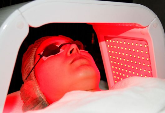 Review: What One Doc’s 4-step Pico Laser treatment can do for your skin